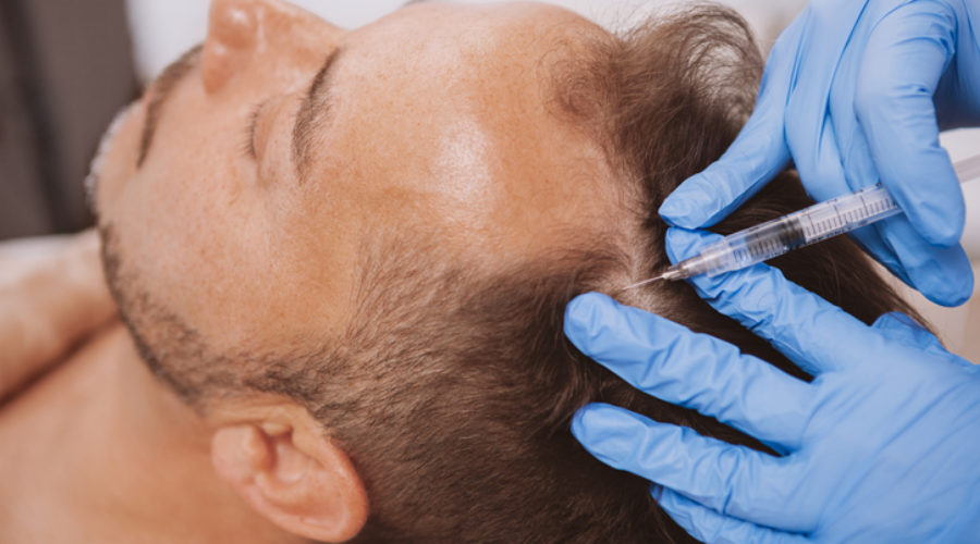 Does the cure for hair loss lie within our blood?